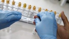 Konak Belediyesinden anonim HIV testi