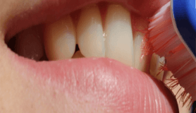 Diş sararmasının nedenleri