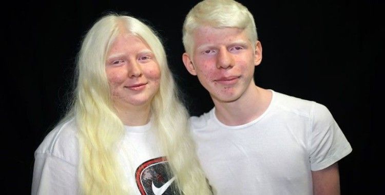 Çukurova'nın albinoları 4 mevsim gölge arıyor