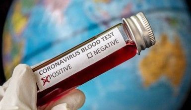 Koronavirüs salgınına ilişkin ülkelerin son durumları…