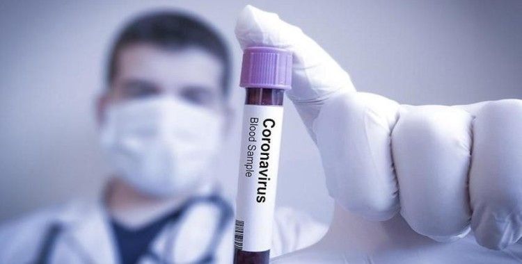 ABD'de Koronavirüsü yüzünden ölenlerin sayısı 93'e yükseldi