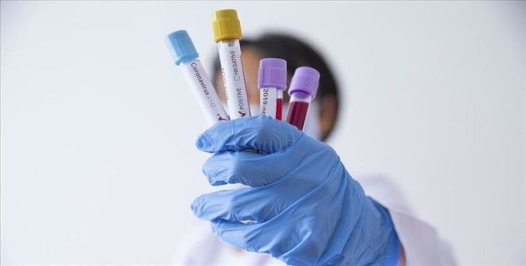 ABD'liler ücretsiz koronavirüs testi yaptırabilecek