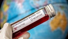 Koronavirüs testi yaptıranlar test sonuçlarına e-Nabız uygulamasından ulaşabilecek