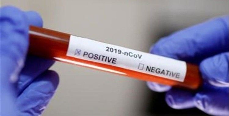 ABD'de Koronavirüs nedeniyle hayatını kaybedenlerin sayısı 217'ye yükseldi