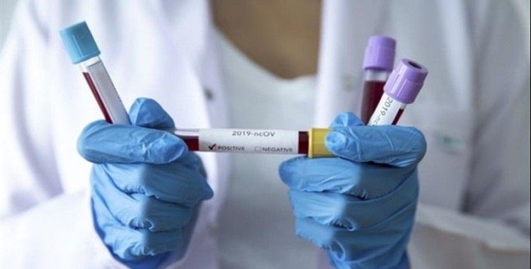 Azerbaycan'da koronavirüsten 4. ölüm