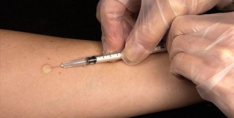 Kovid-19'a karşı çalışmaları sürdürülen aşı, eylüle kadar insanlar üzerinde denenmeye başlanacak
