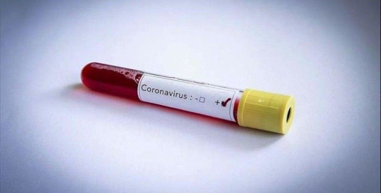 Hollanda'da koronavirüsten ölenlerin sayısı bini aştı