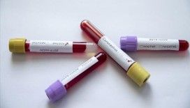 Afrika'nın 6 ülkesinde henüz Kovid-19 vakası görülmedi