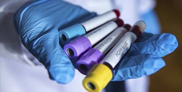 Azerbaycan'da koronavirüsten 5. ölüm