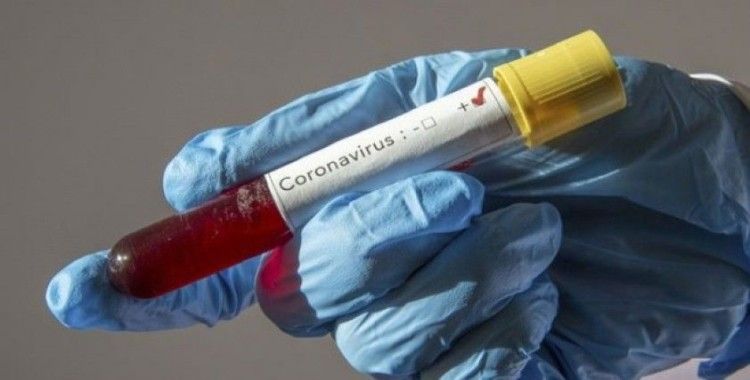 KKTC'de koronavirüs vaka sayısı 77'ye yükseldi
