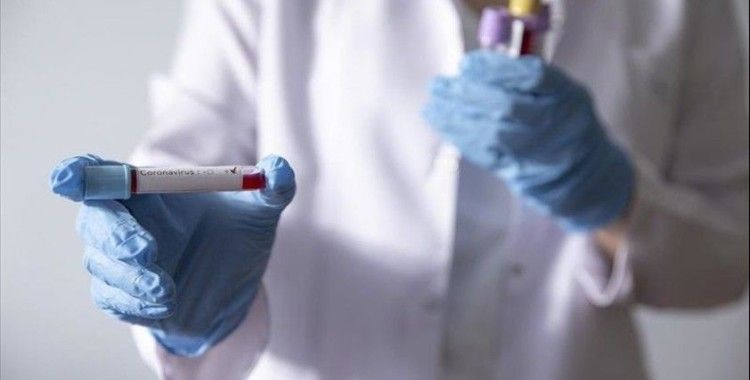 Japonya koronavirüsüne iyi gelen ilaç için klinik çalışmalara başladı