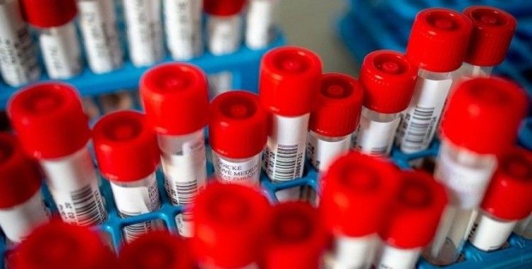 Sağlık Bakanlığı Referans Laboratuvarı'nda Kovid-19 virüsü izole edildi