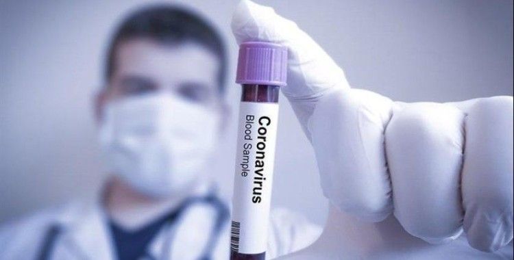 Rusya'da koronavirüsü vaka sayısı 10 bini aştı