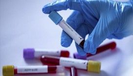 Gürcistan'da koronavirüs vaka sayısı 400'ü geçti