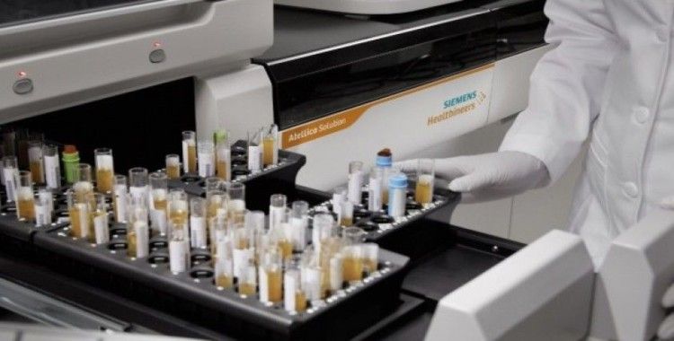 Koronavirüse karşı bağışıklık ölçen test