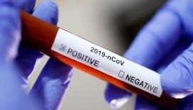 New York'ta 15 çocukta Covid-19 bağlantılı yeni hastalık şüphesi