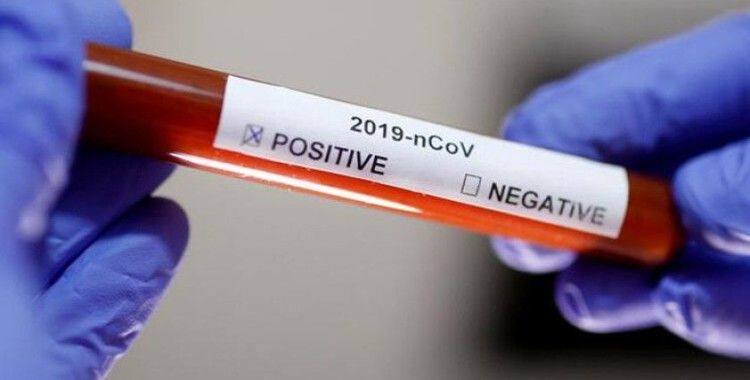 İftarda bir araya gelen iki aileden 5 kişi koronavirüse yakalandı