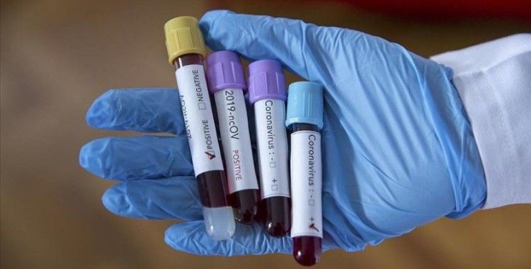 İran'da koronavirüsten hayatını kaybedenlerin sayısı 7 bine yaklaştı