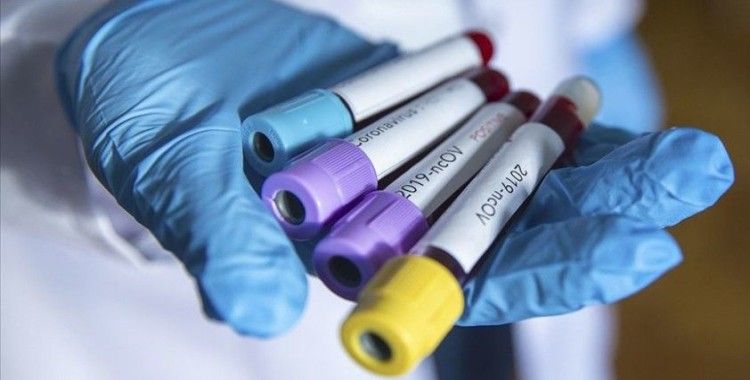 Van'da koronavirüsten bir kişi hayatını kaybetti
