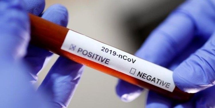 İran'da koronavirüs nedeniyle can kaybı 8 bin 12'ye yükseldi