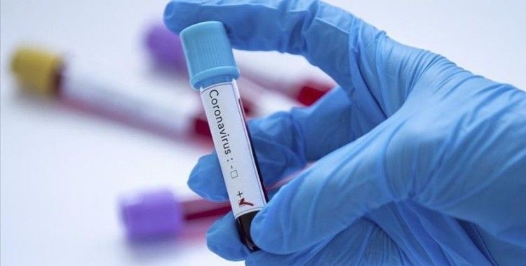 Hakemlerin koronavirüs testleri negatif