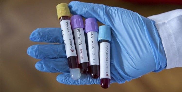 Brezilya'da koronavirüs vakaları 1 milyonu aştı