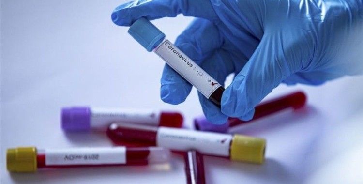 Akhisarspor'da 12 kişide koronavirüs tespit edildi