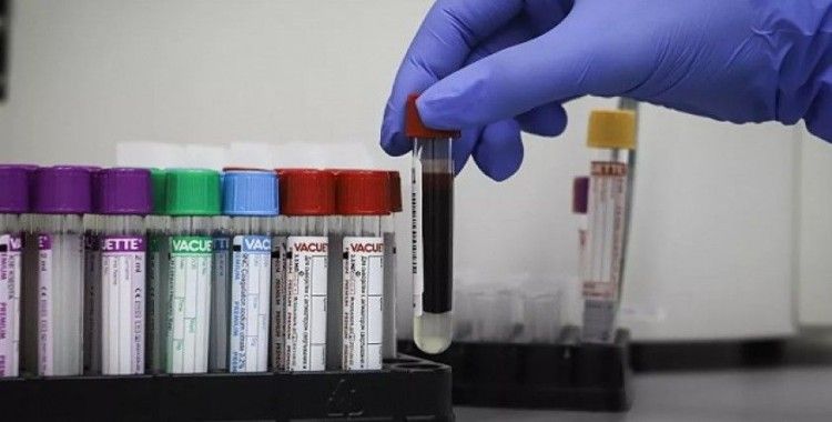 Kovid-19 test analizi yapılan laboratuvarda 240 kişi virüse yakalandı