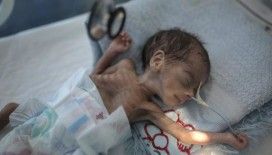 UNICEF: Covid-19 Yemen'de milyonlarca çocuğu açlığın eşiğine itebilir