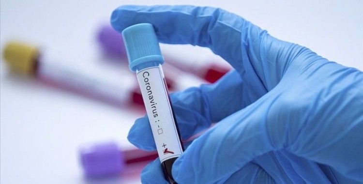 Filistin'de 59 koronavirüs vakası daha tespit edildi