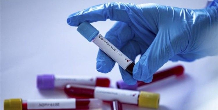 Azerbaycan'da son 24 saatte 396 yeni koronavirüs vakası