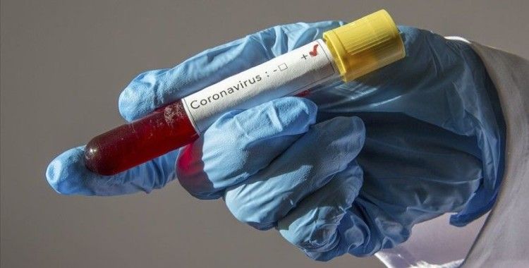 Azerbaycan'da son 24 saatte 318 yeni koronavirüs vakası tespit edildi