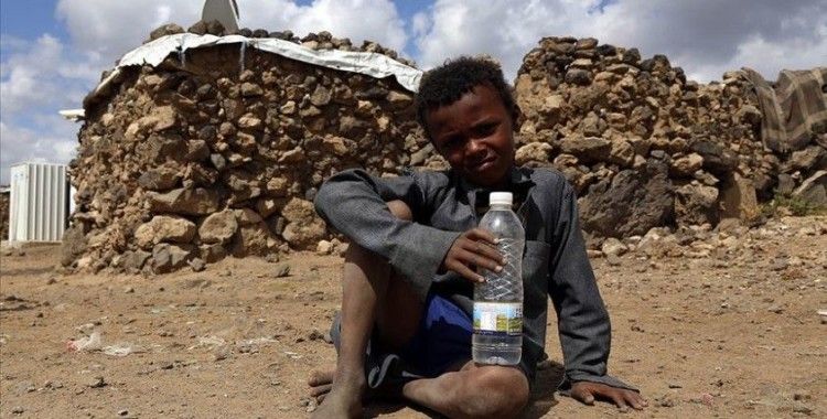 BM Yemen'deki trajik durum konusunda uyardı: Binlerce çocuk ölebilir
