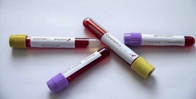 Koronavirüs spor camiasını etkilemeye devam ediyor