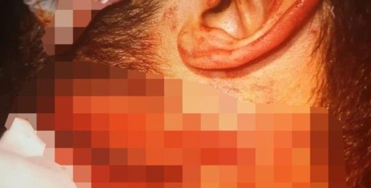 İzmir'de doktorun boğazını kesen saldırgana 20 yıl hapis cezası verildi