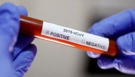 İsveç'te koronavirüs için yeni hızlı test geliştirildi