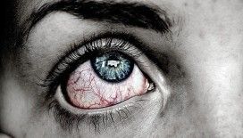 Koronavirüs belirtileri gözlerde de görülebiliyor 