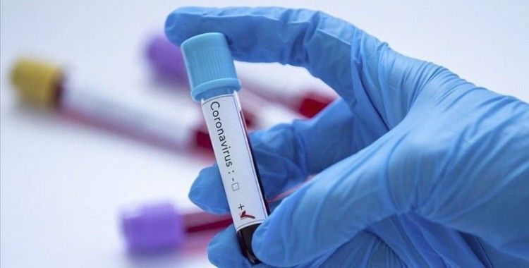 Konyaspor'da bir futbolcunun Kovid-19 testi pozitif çıktı