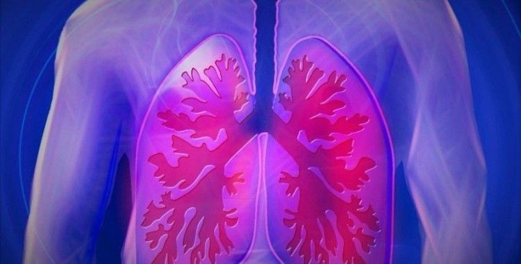 Akciğer kanserinde erken teşhis başarı şansını artırıyor