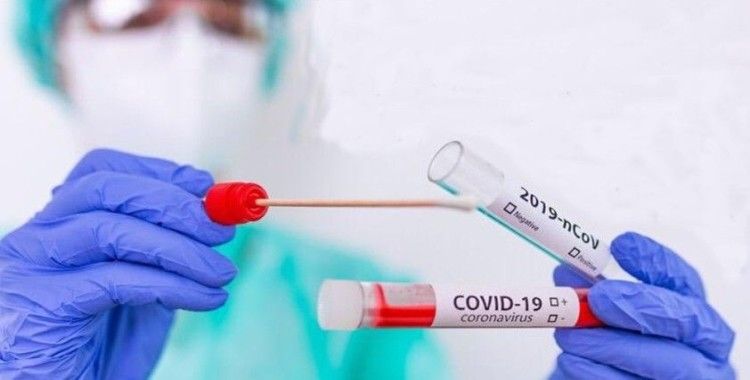  Japonya’dan WHO’nun Covid-19 tedavisinde "etkisiz" dediği Remdesivir ile ilgili açıklama