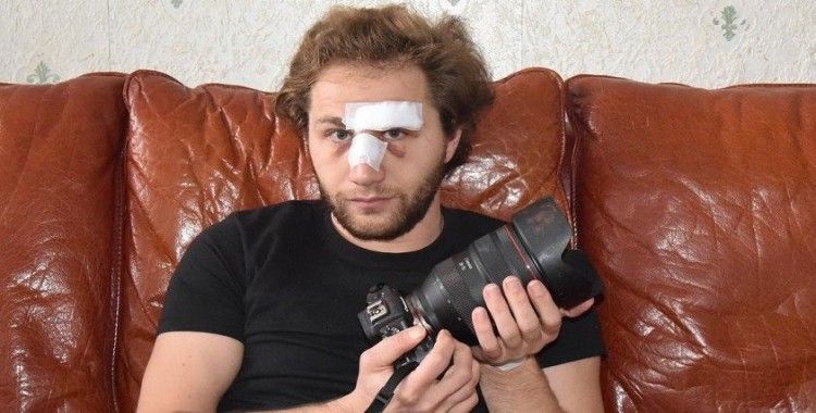 Paris'te polis şiddetine maruz kalan Suriyeli gazeteci Al Halbi: Başıma gelenler Suriye'de yaşadıklarımı hatırlattı