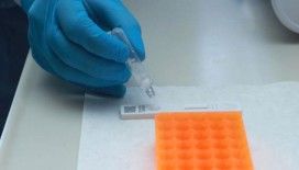 KKTC’ye 90 bin tanı kiti hibe edilecek