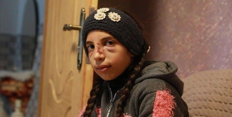 Yahudi yerleşimcilerin saldırısından zor kurtulan Filistinli küçük kız korku içinde yaşıyor