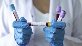 Almanya'da son 24 saatte 17 bin 504 koronavirüs vakası