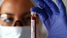 İngiltere'de yeni deney: Hastalığı geçirmiş olanlara yeniden koronavirüs bulaştırılacak