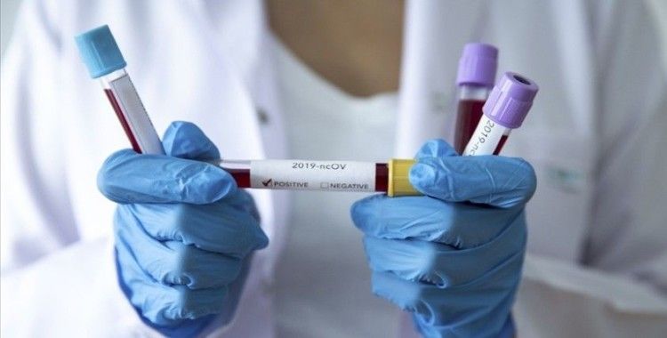 Almanya'da son 24 saatte koronavirüsten 259 kişi öldü