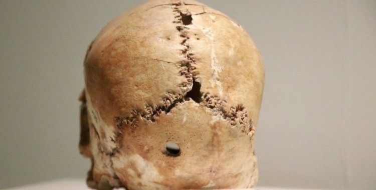 Dünyadaki ilk beyin ameliyatının yapıldığı Aşıklı Höyük 11 bin yıllık tarihe ışık tutuyor
