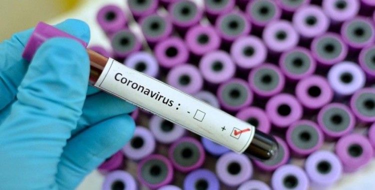Son 24 saatte koronavirüsten 260 kişi hayatını kaybetti