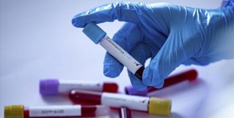 KKTC'de ve Kıbrıs Rum kesiminde en yüksek günlük Kovid-19 vaka sayıları kaydedildi