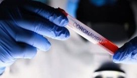 Son 24 saatte koronavirüsten 84 kişi hayatını kaybetti